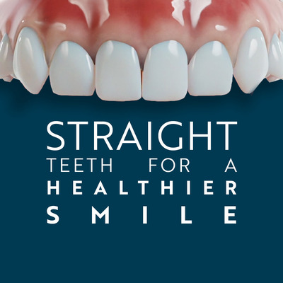 Straight Teeth for a Healthier Smilev